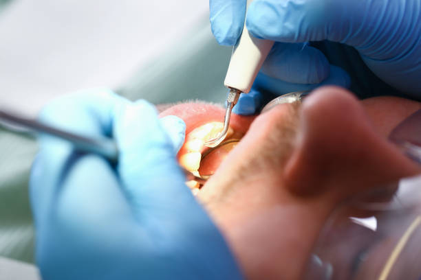 Best Urgent Tooth Repair  in Punta Gorda, FL